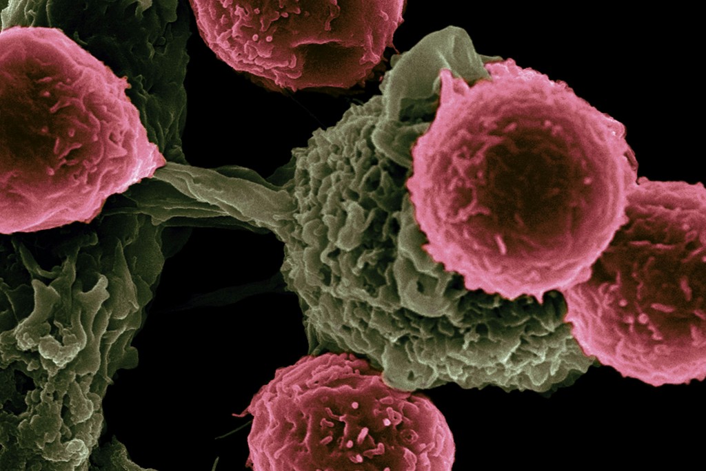 Krebszellen für einmal sichtbar: Die Evaluation zeigt, dass das Krebsregistierungsgesetz Fortschritte erzielt hat, es gibt aber weiteren Handlungsbedarf. (Foto: National Cancer Institute / Unsplash)