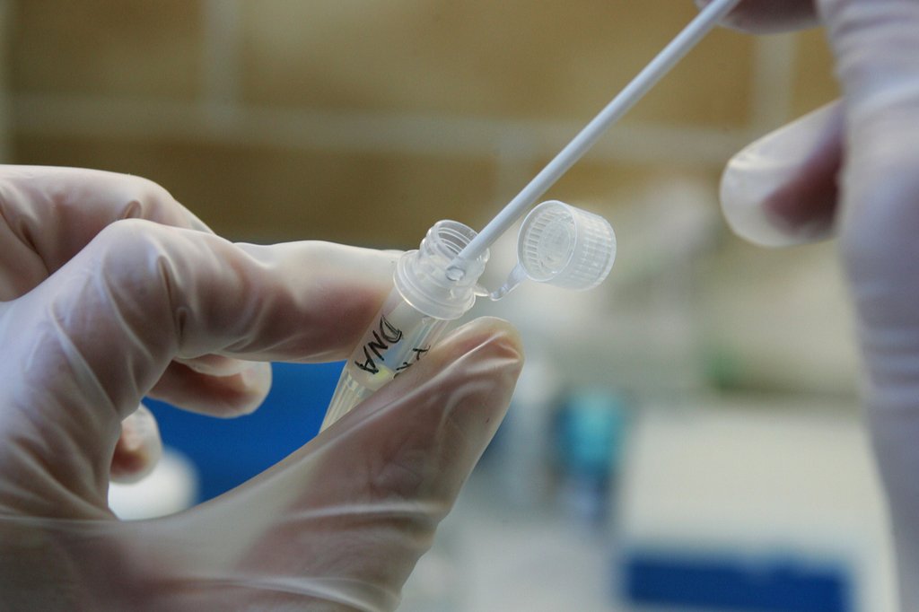 Die Evaluation zeigt, dass die Aufsicht über die Gentest-Laboratorien zweckmässig ist und auch, dass die die Laboratorien sich an die gesetzlichen Vorgaben halten. (Foto: Keystone / AP / Thomas Kienzle)
