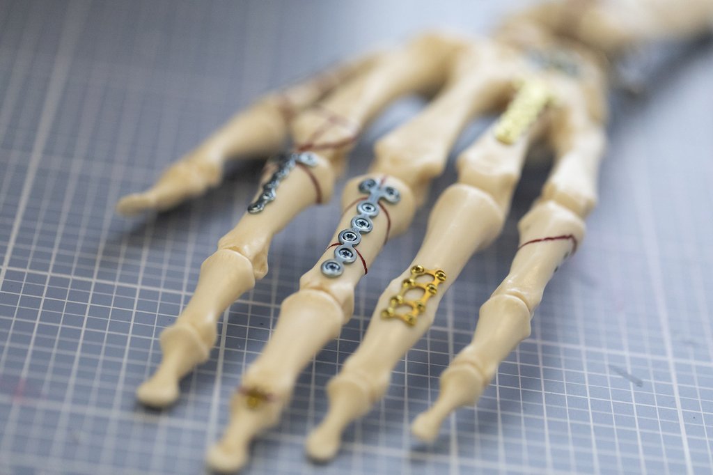 Betroffen sind alle, wenn auch unterschiedlich: Hersteller von Medizinprodukten tragen im Schnitt weniger hohe Kostensteigerungen als Handels- und Importunternehmen. (Foto: Keystone / Gaëtan Bally)